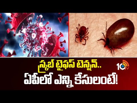 Scrub Typhus Cases Rise in AP | స్క్రబ్ టైఫస్ టెన్షన్.. ఏపీలో ఎన్ని కేసులంటే! | 10TV - 10TVNEWSTELUGU