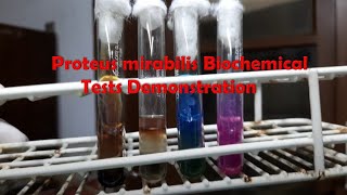 Proteus mirabilis biochemical tests Demonstration