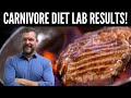 Carnivore Diet will do this to Your Labs [Carnivore Diet Results]- 2026
