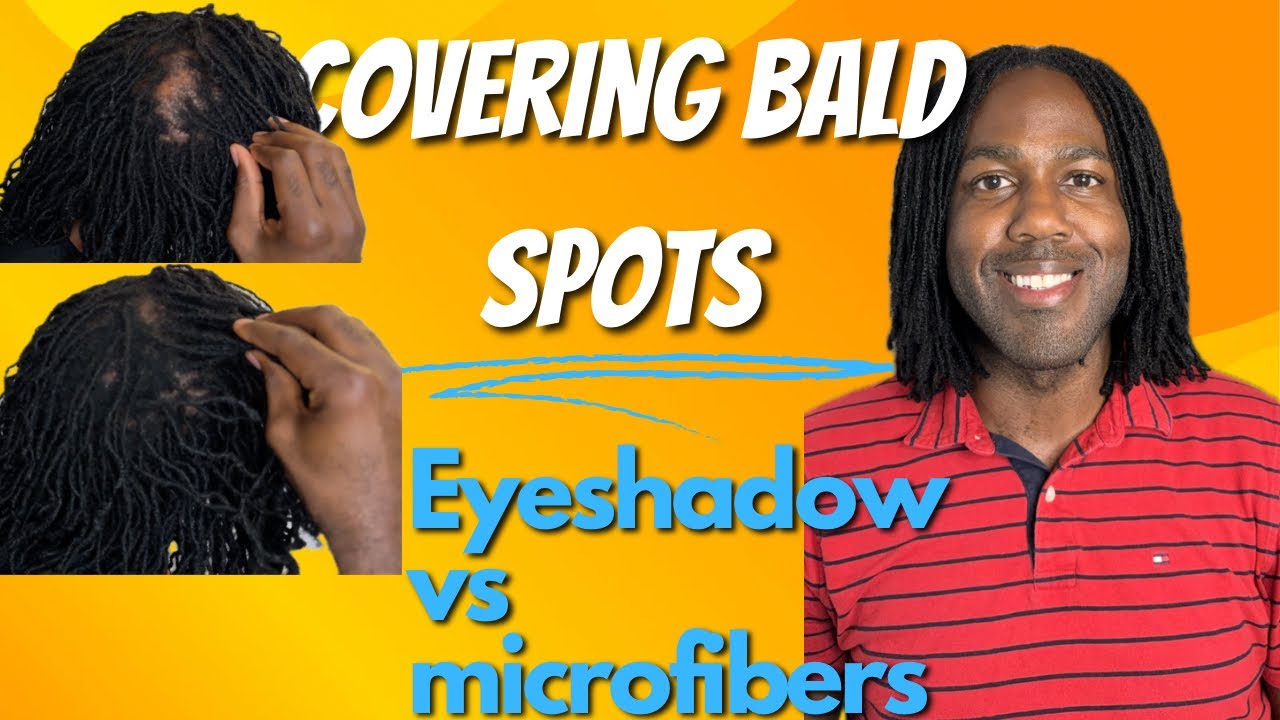microlocs-how-i-hide-my-bald-spot-2-methods-that-work-to-conceal-a