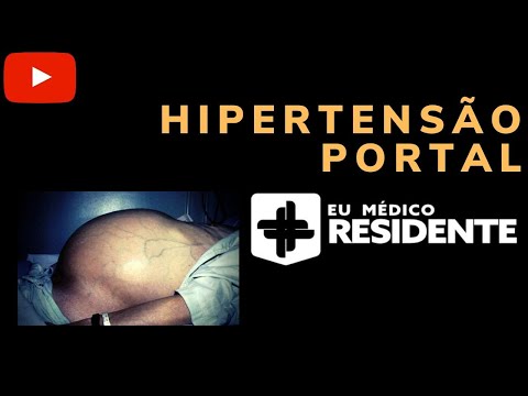 Hipertensão Portal para Residência Médica