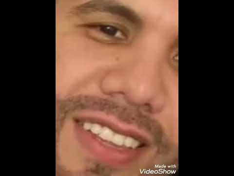 الصور الأولى للمطرب عمر كمال بعد عملية تجميل زراعة الدقن