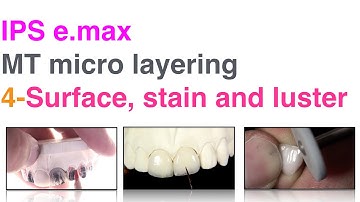 IPS e max MT micro layering 4 Surface, stain and luster