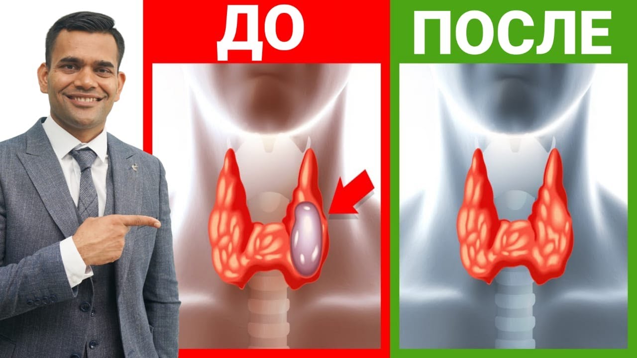 Физиология щитовидной железы. Гипер и гипотериоз.Physiology of the thyroid gland. Hyperthyroidism...