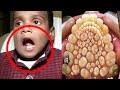 Bambino scopre di avere 500 denti dopo una visita dal dentista