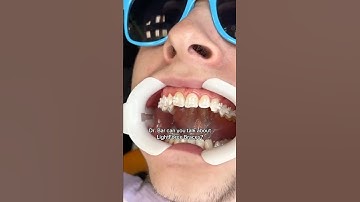 What are LightForce Braces?