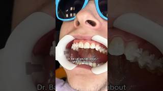 What Are Lightforce Braces?