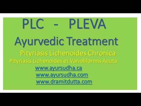 PLC, PLEVA, Pityriasis Lichenoides Treatment @ AYUR-SUDHA Jalandhar,India. Brampton, Canada
