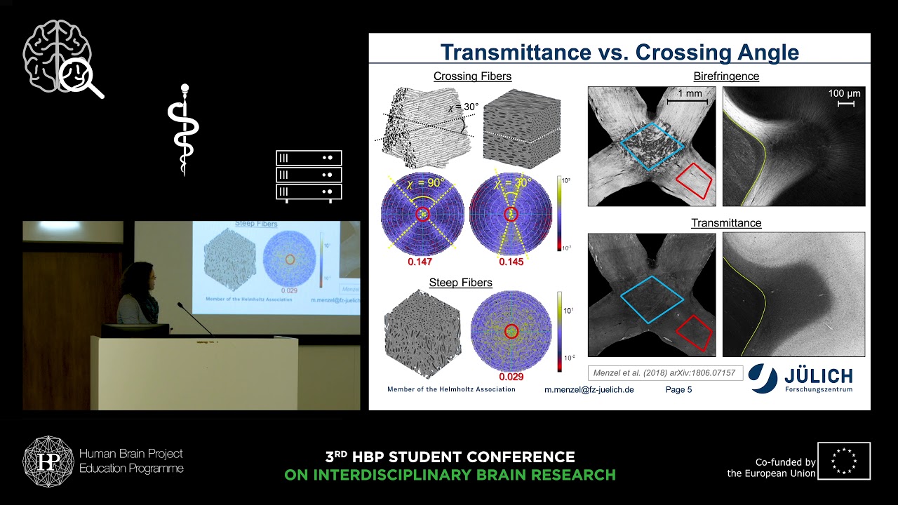 Menzel Miriam - Transmittance and diattenuation of brain tissue