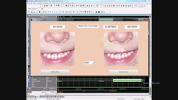 A Real-Time FHD Learning Based Super Resolution System Without a Frame Buffer