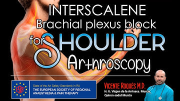 SHOULDER REGIONAL ANESTHESIA  INTERSCALENE BRACHIAL PLEXUS BLOCK.
