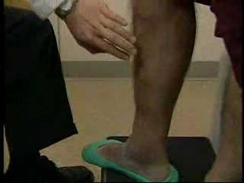 EVLT Varicose Vein Laser Treatment