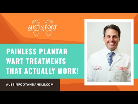 Painless Plantar Wart Treatments That Actually Work!