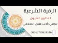 رقيه لتطهير العيون رقيه لتطهير العيون
