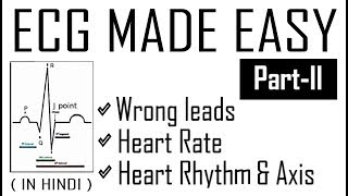 ECG MADE EASY - Part 2 | Interpretation of Wrong leads, Heart Rate, Rhythm & Axis | Dr.EDUCATION |