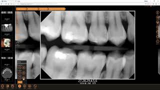 Training: Apteryx XVWeb: Adjust and Enhance Images in XVWeb 2.0