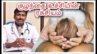 Baby's soft spot (Fontanel) mystery | Tamil | Dr Sudhakar | screenshot 5