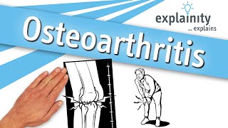 Osteoarthritis explained (explainity® explainer video)