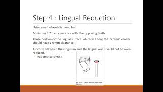 TOOTH PREPARATION FOR PORCELAIN FUSED METAL CERAMIC CROWN