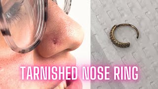 Jony's Vlog 007: Tarnished Nose Ring REMOVAL!!