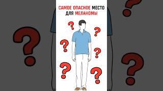 ГДЕ ПРЯЧЕТСЯ МЕЛАНОМА? #онколог #онкология #рак #опухоль