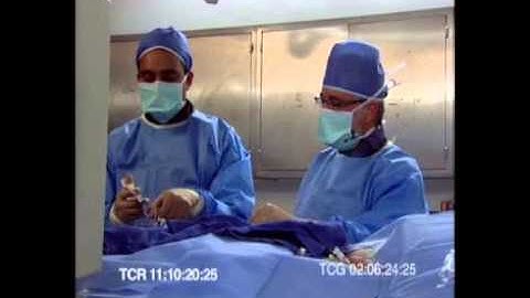 Catheter Ablation for Atrial Fibrillation - Access - Arrhythmia.org Webcast 2