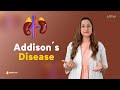 Addison’s Disease | Endocrinology Lecture for Medical Students | V-Learning™