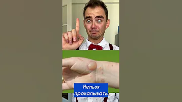 ВОПРОС ЖИЗНИ 😳😳😳 Лайфхак, который подскажет, что делать, если тебя обожгла медуза 😎
