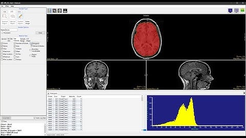 Analyze 14.0 - Measure: 2D Sample Closed Trace