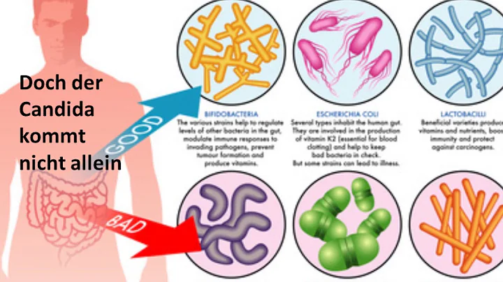 Candida - unklare Symptome bei Hefepilzbesiedlu...