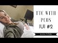 IUI Day | Attempt #2 | Trigger Shot I Infertility Journey I TTC