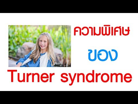 พบหมอเสรี ตอนที่ 161 : ความพิเศษของ Turner syndrome