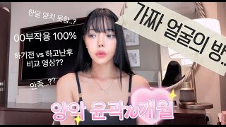 양악 10개월차 후기 l wiw위우 다이어트 헬스 운동복  유투버 koreanvlog