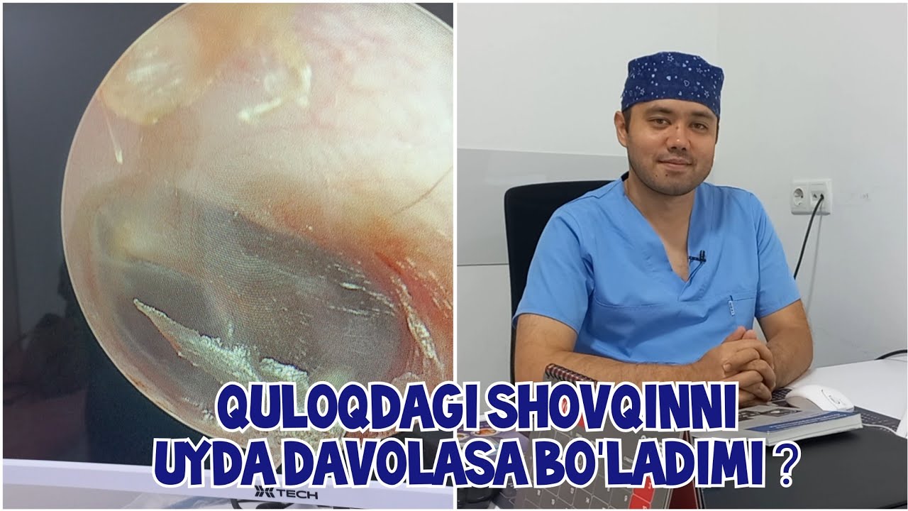 Quloqdagi shovqinni bepul, 