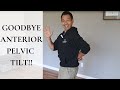 How to "Fix" and Prevent Anterior Pelvic Tilt (GOODBYE APT!)