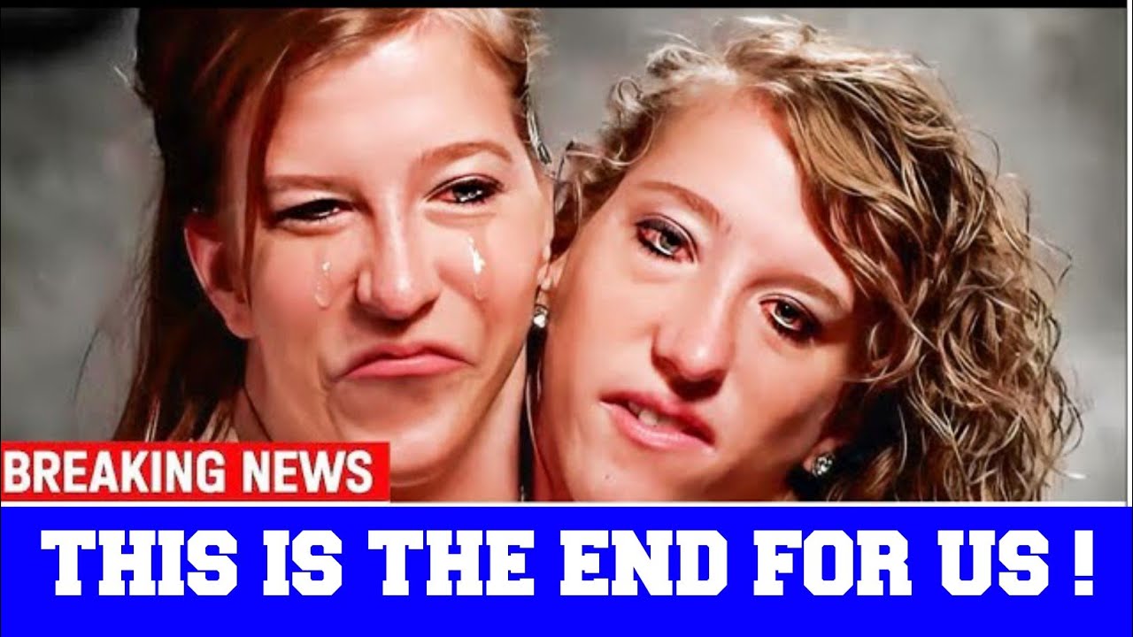 This is Heartbreaking Moment ! Coordinating When You're Conjoined Twins ...
