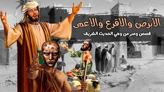 قصة الأبرص والأقرع والأعمى | من وحي الحديث النبوي الشريف