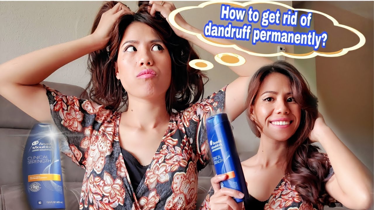 Head and Shoulder Clinical strength honest review | How to get rid of dandruff fast - YouTube