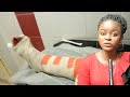 Chancella Tshala victime d'un accident de circulation, elle s'est fracturée le pied droit. Vos soutiens lui guérira promptement ( VIDEO )