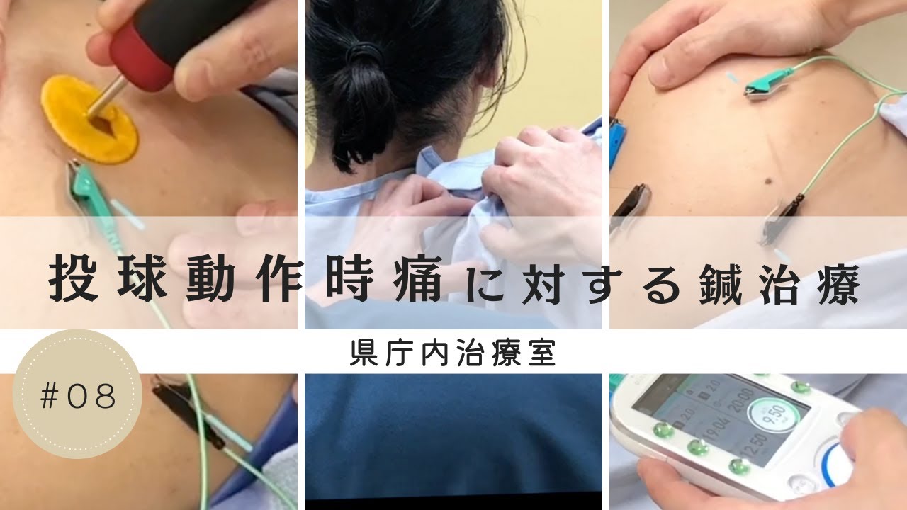 投球動作時痛に対する鍼治療　県庁内治療室