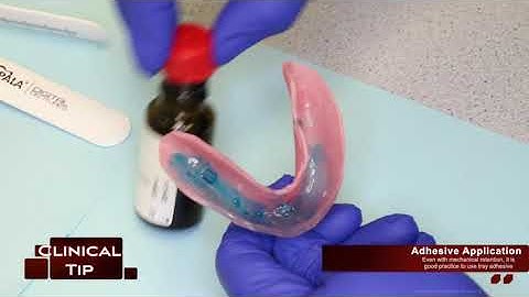 CDJ: 4) Custom Tray Appointment