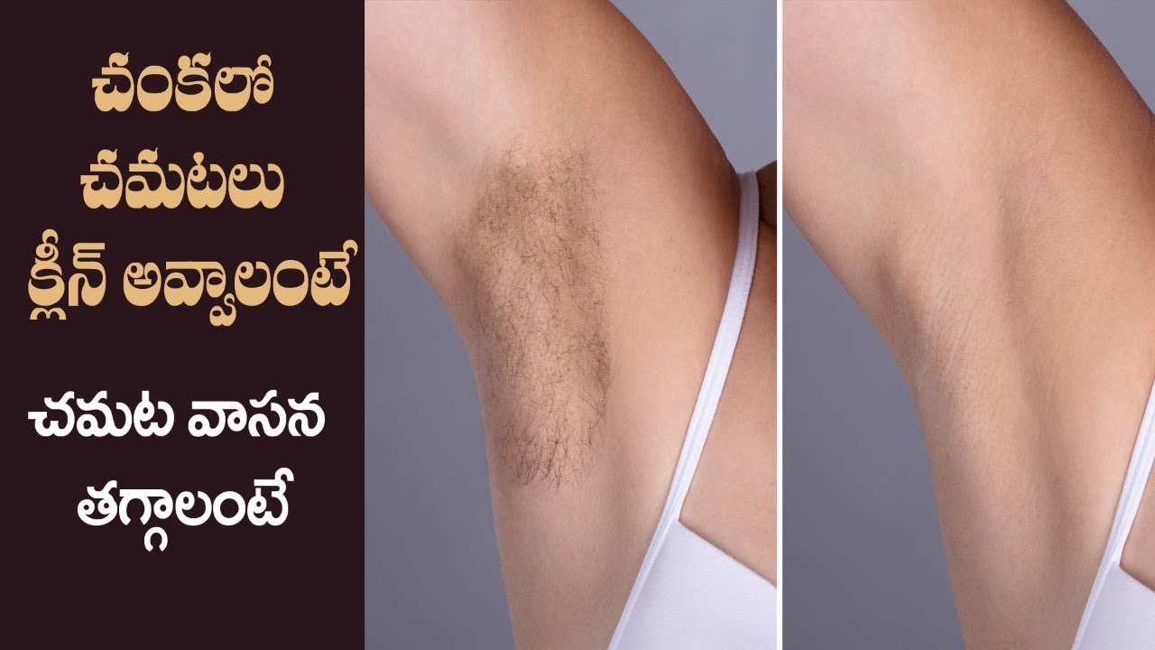 Get Rid of Underarms Smell | Best Remedy to Reduce Body Odour | Armpit | Dr.Manthena's Health Tips