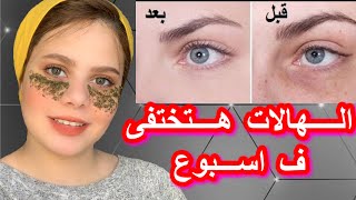 اسهل  5 طرق لعلاج الهالات السوداء/تجنبى هذه العادات اليوميه(هى سبب الهالات)