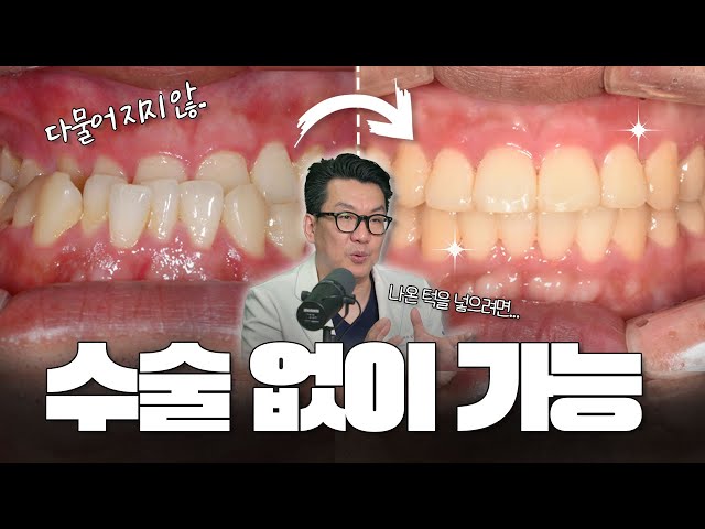 주걱턱, 수술보다 교정으로 치료해야 하는 이유
