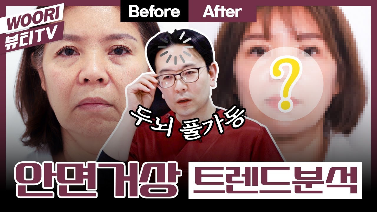 안면거상술에 대해 얼마나 알고 계신가요?