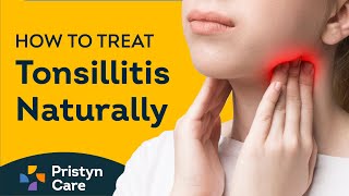 How to Treat Tonsillitis | Home remedies for Tonsillitis