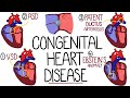 Congenital Heart Malformations Made Easy (8 Main Types)