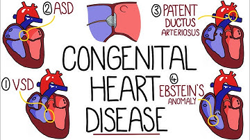 Congenital Heart Malformations Made Easy (8 Main Types)