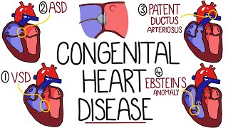 Congenital Heart Malformations Made Easy (8 Main Types) by Rhesus Medicine 35,588 views 7 months ago 19 minutes