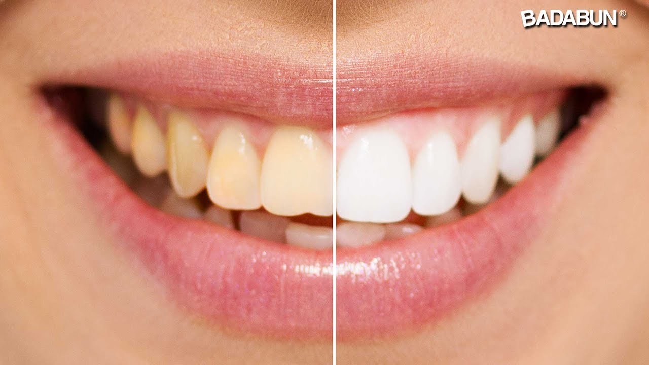 como limpiar los dientes con bicarbonato y sal